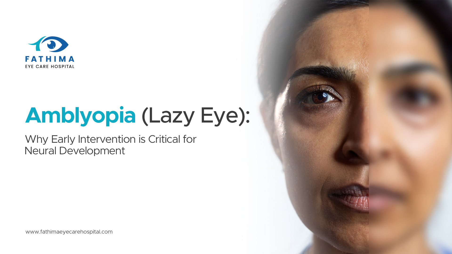 Amblyopia (Lazy Eye): Why Early Intervention is Critical for Neural Development