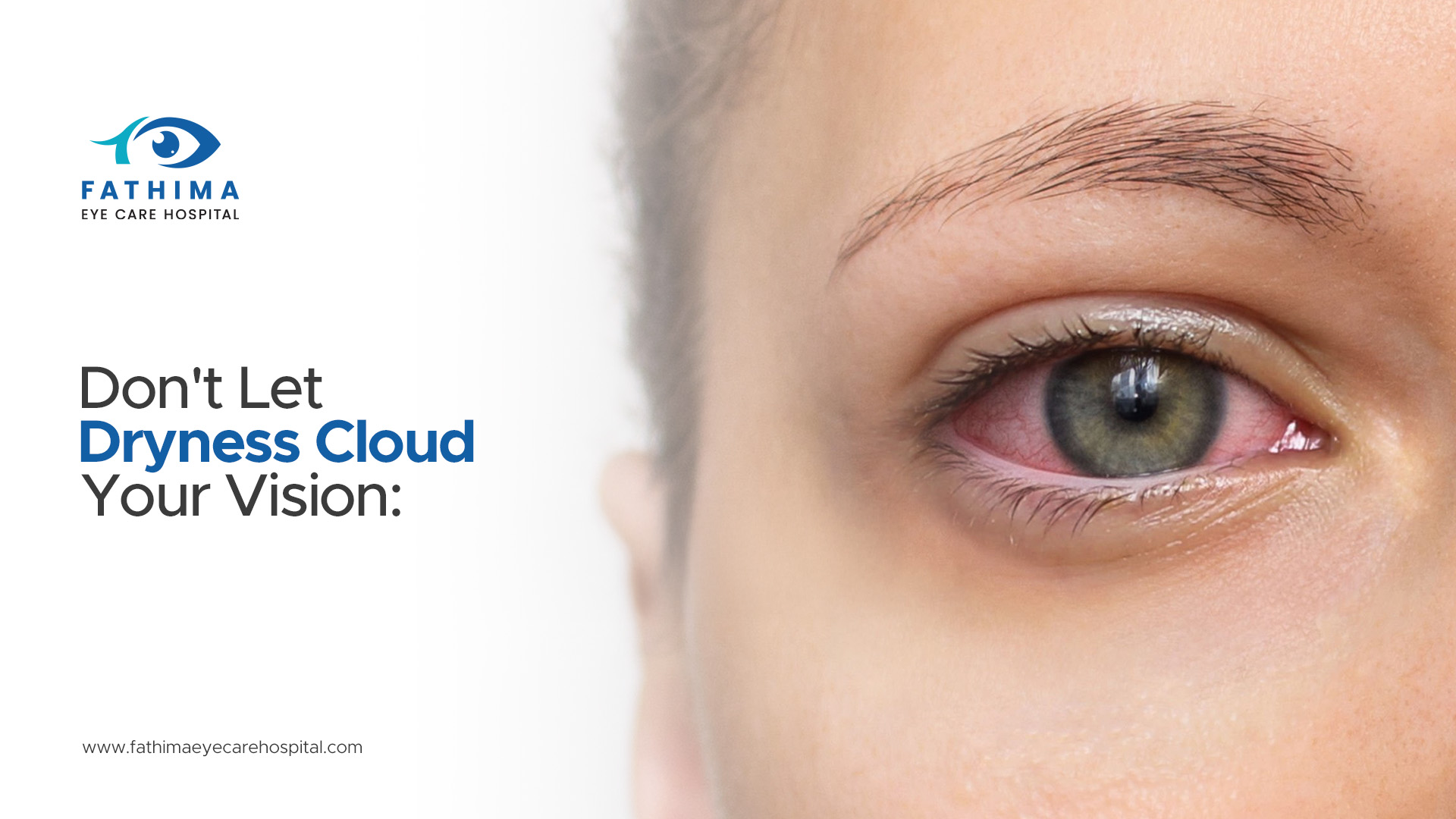 Don't Let Dryness Cloud Your Vision: Why Managing Dry Eye is Essential Before Cataract Surgery
