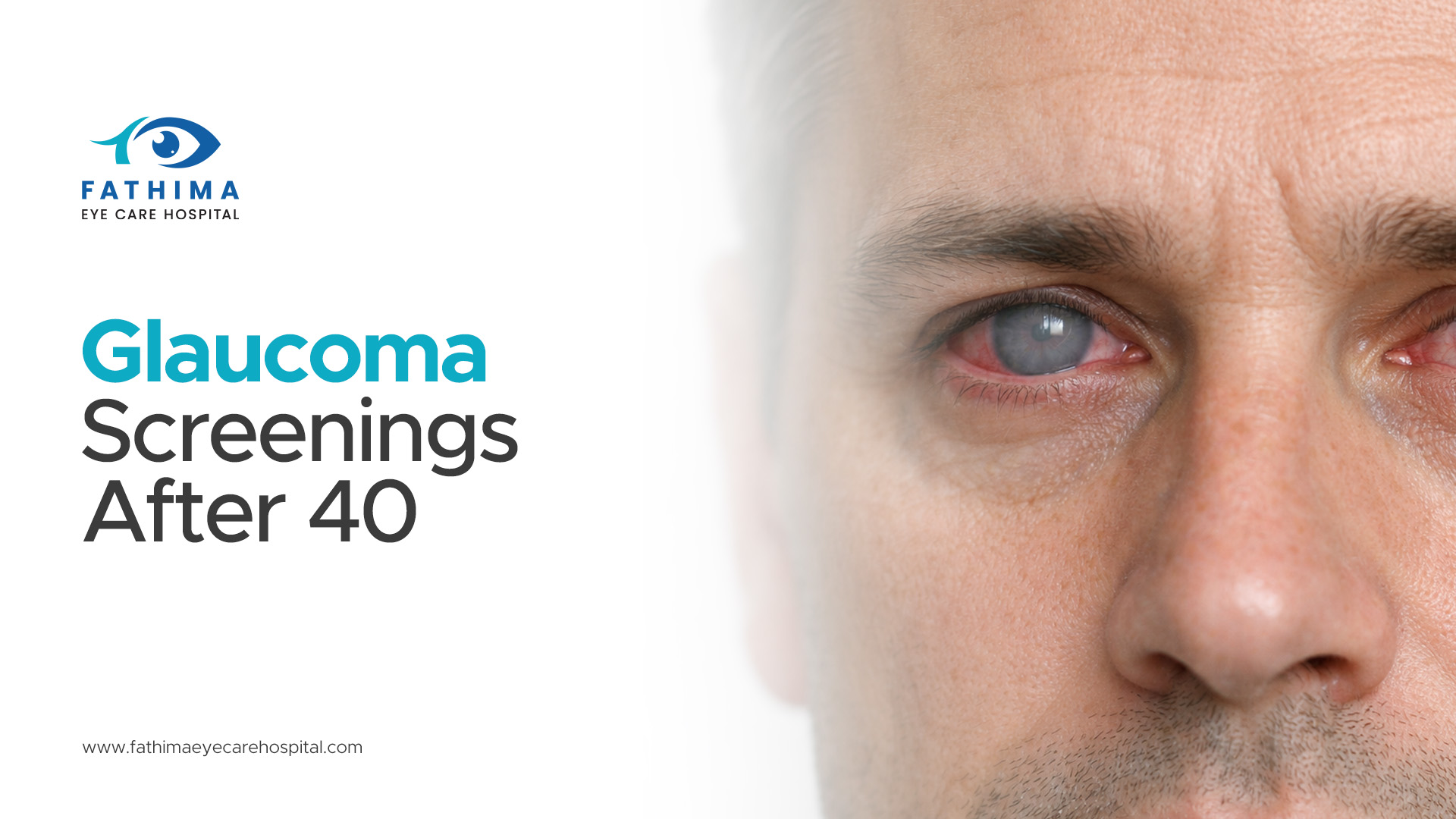 Glaucoma Screenings After 40: Why They're Crucial for Preserving Vision
